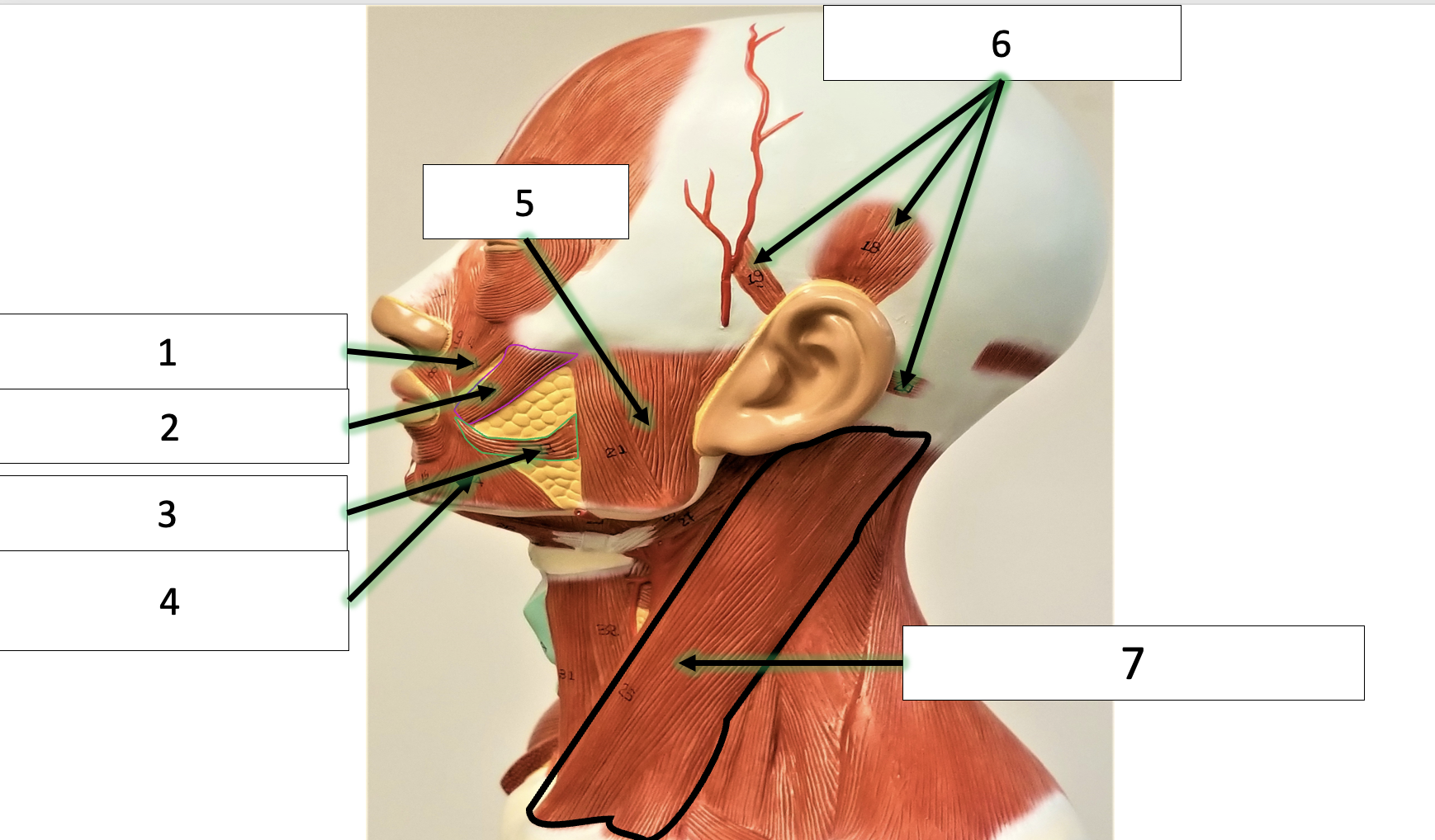 <p>name the muscle (2)</p>