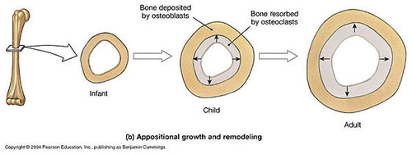 <p>increase in bone thickness</p>