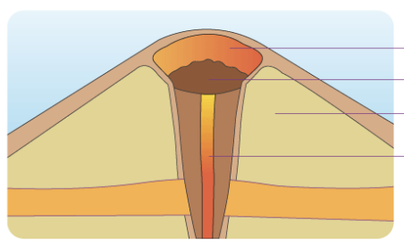 <p><strong>TYPES OF VOLCANO:</strong></p><p>this is <strong>circular or oval made up of small fragment of lava from a single vent</strong> that have been flown up;</p><p><strong>low-viscosity lava;</strong></p><p>results from eruptions of mostly small pieces of scoria and pyroclastic that build up around the vent</p><ul><li><p>ex. Smith Volcano (Babuyan Island)</p></li></ul><p></p>