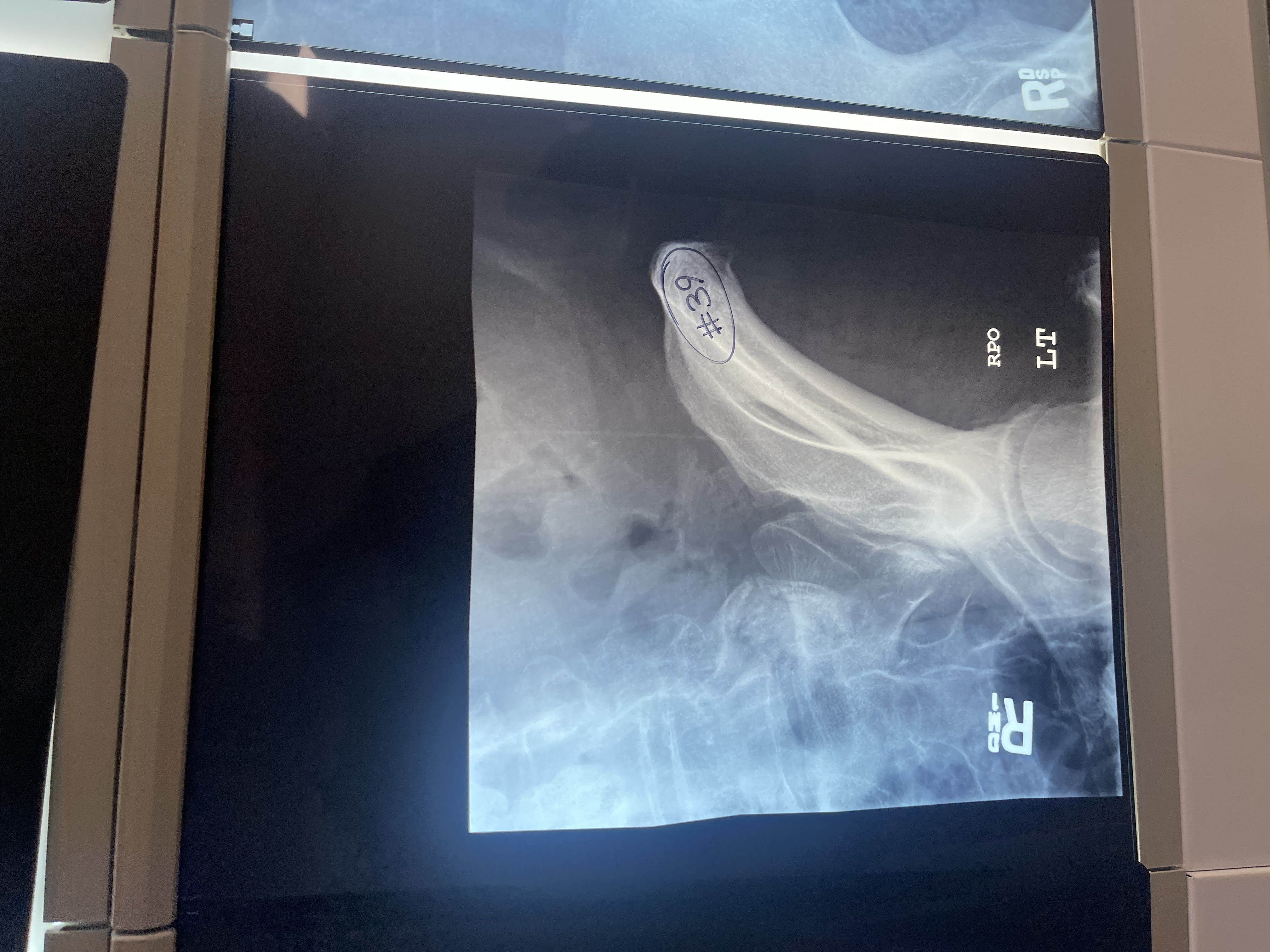 <p>what’s wrong with # 39 AP axial oblique of the left SI joint</p>