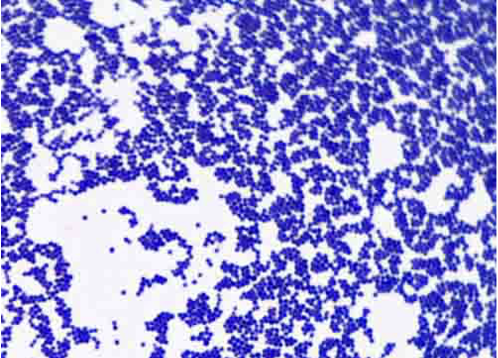 Staphylococcus epidermis (acid fast stain) 