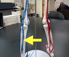 <p>Name the blood vessel.</p>