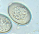 <p>Small but variable egg with centrally located morula or spores (depending on development), may see a micropyle cap if you are lucky</p>