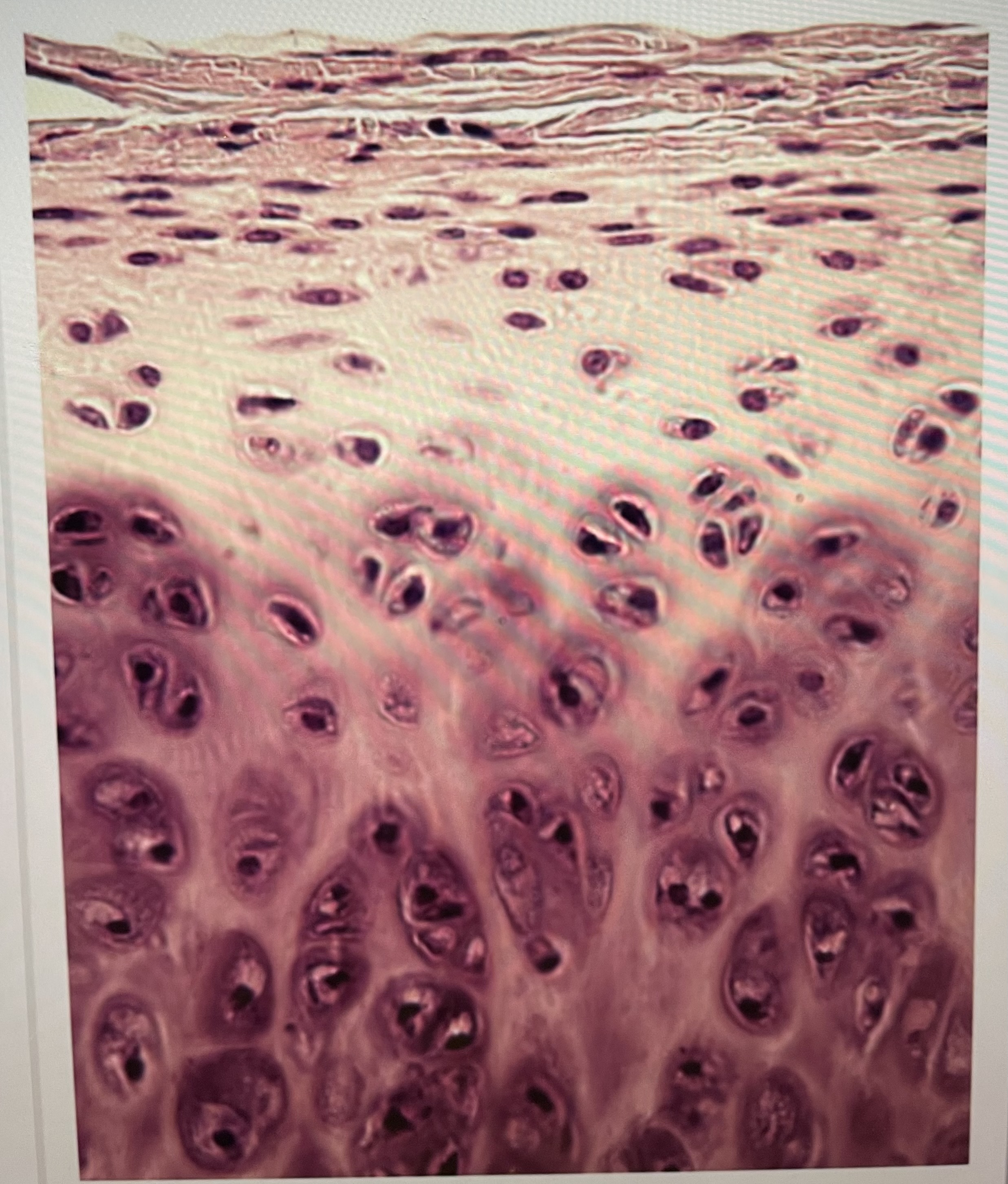 The tissue above is best describes as 