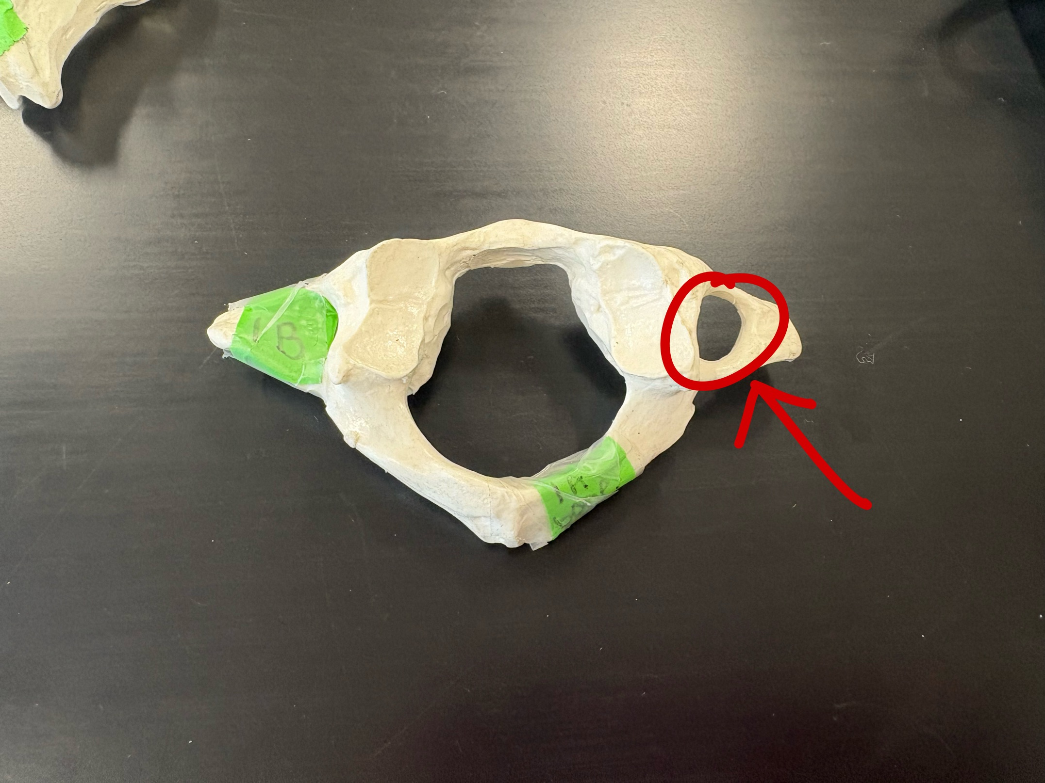 <p>Name this structure</p>