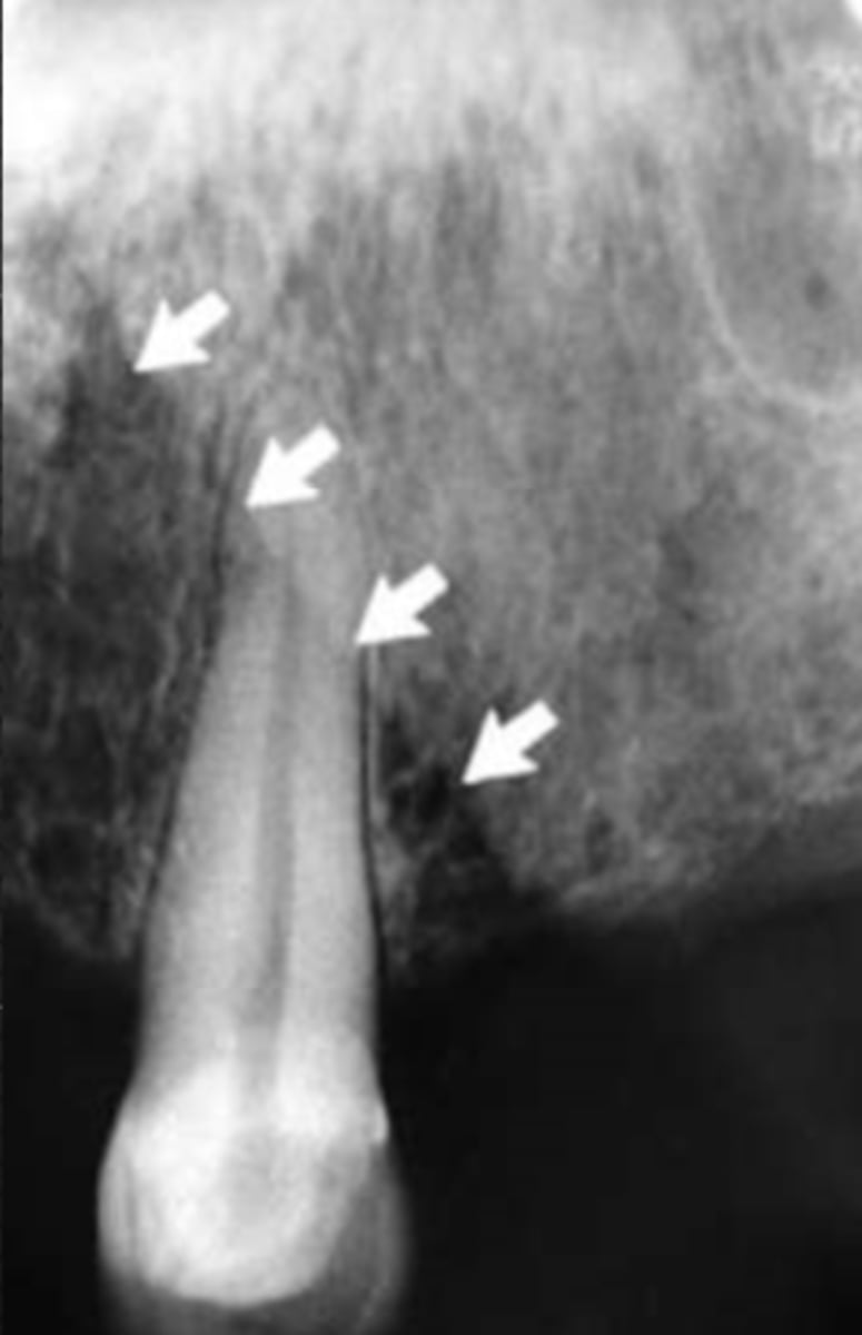 <p>Identify the structure</p>
