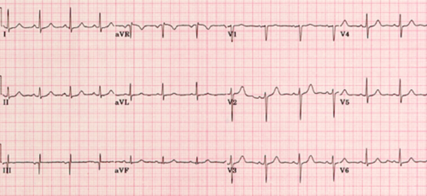 <p>What are the findings</p>