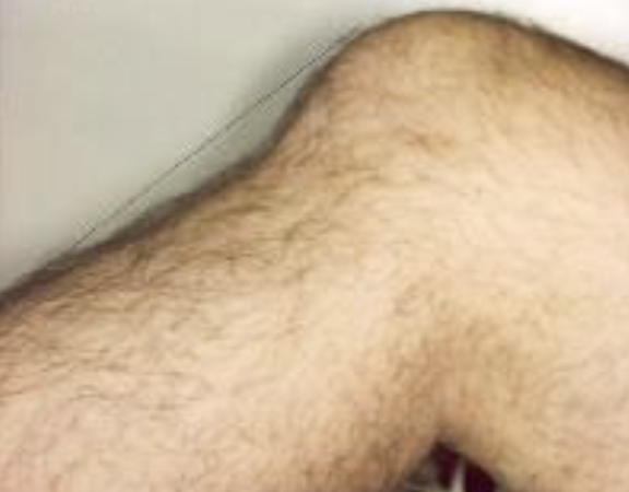 what is this? what injury is it related to?