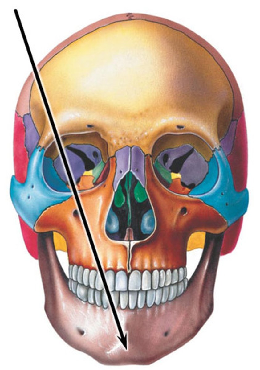 <p>The prominence of the chin at the anterior part of the mandible.</p>