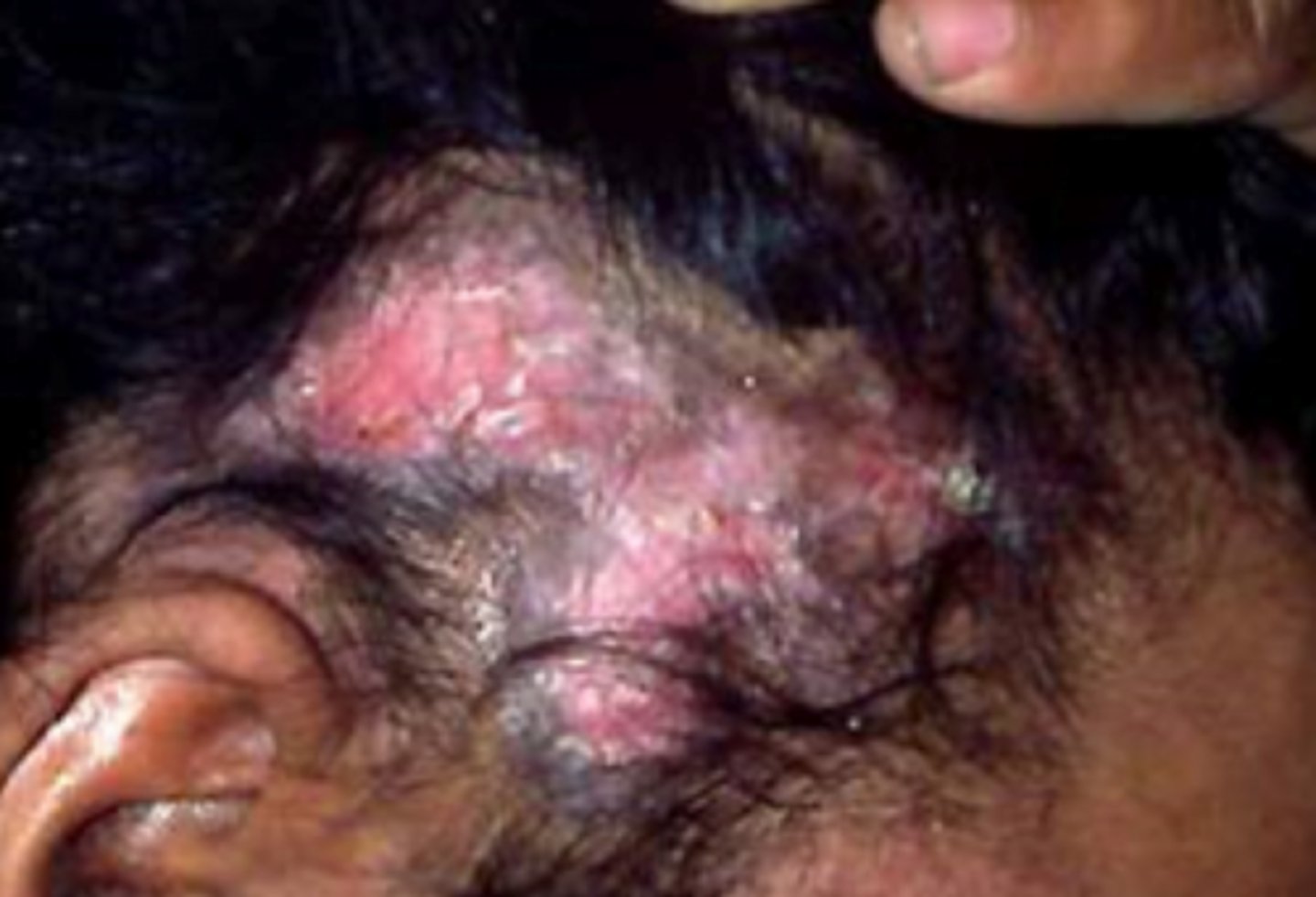 <p>What is the diagnosis?</p>