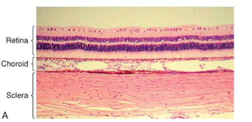 <p>choroid&nbsp;</p>