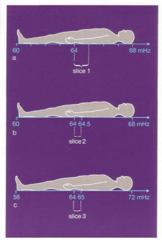 <p>We send in an RF pulse that has a range of frequencies.</p><p>The wider the range, the thicker slice of protons will be excited</p><p>In sequence a, we used a range of RF frequency from 64 mHz to 65 mHz, to produce slice 1</p><p>If however in sequence b we use a frequency range from 64 mHz to 64.5 mHz , we will produce slice 2 which is thinner than slice 1</p>