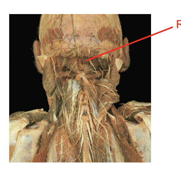 <p>What is this muscle:What is its origin. Where does it inserts. </p>