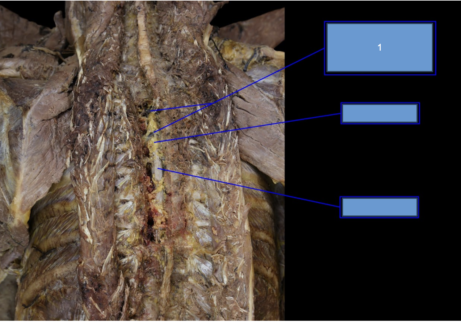 <p>What vein is this</p>