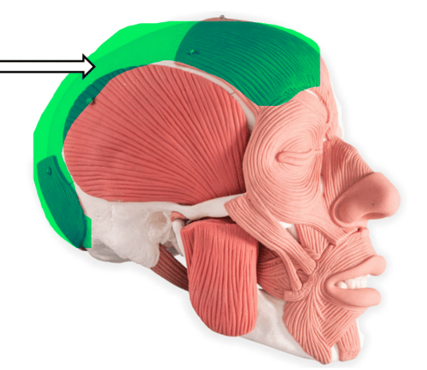 <p>name the muscle</p>