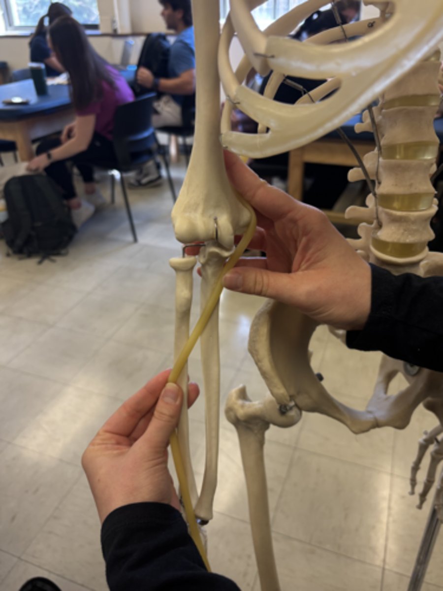 <p>What is this muscle?</p>