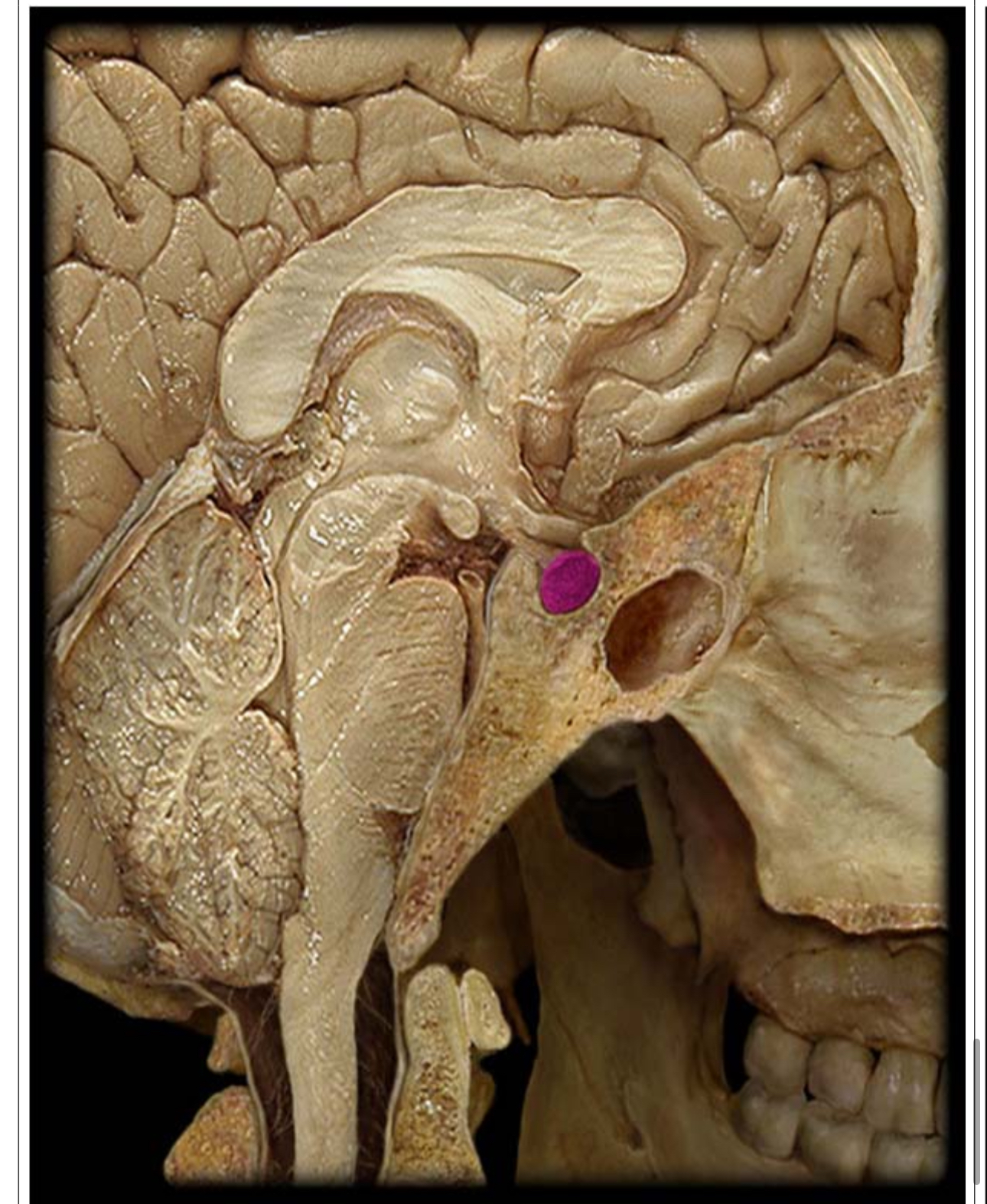 <p>What gland is this</p>