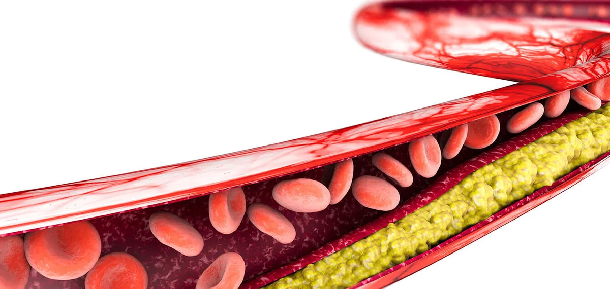 LDL und HDL
