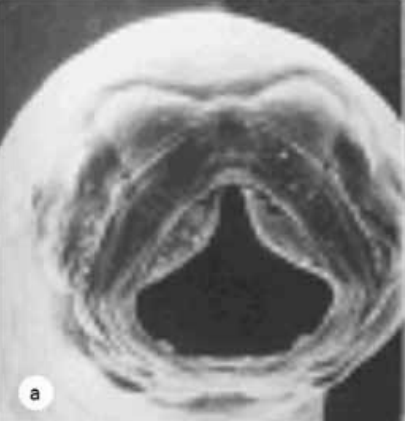 The buccal capsule of N. americanus has a ventral pair of ?