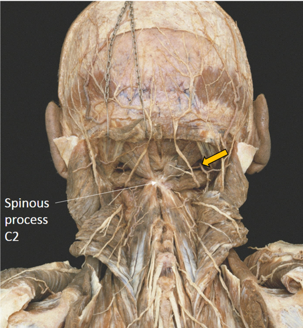 <p>What is the yellow arrow pointing at? </p>