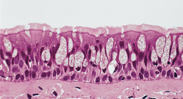 <p>what tissue is this</p>