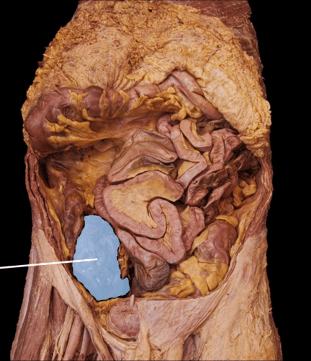knowt flashcard image