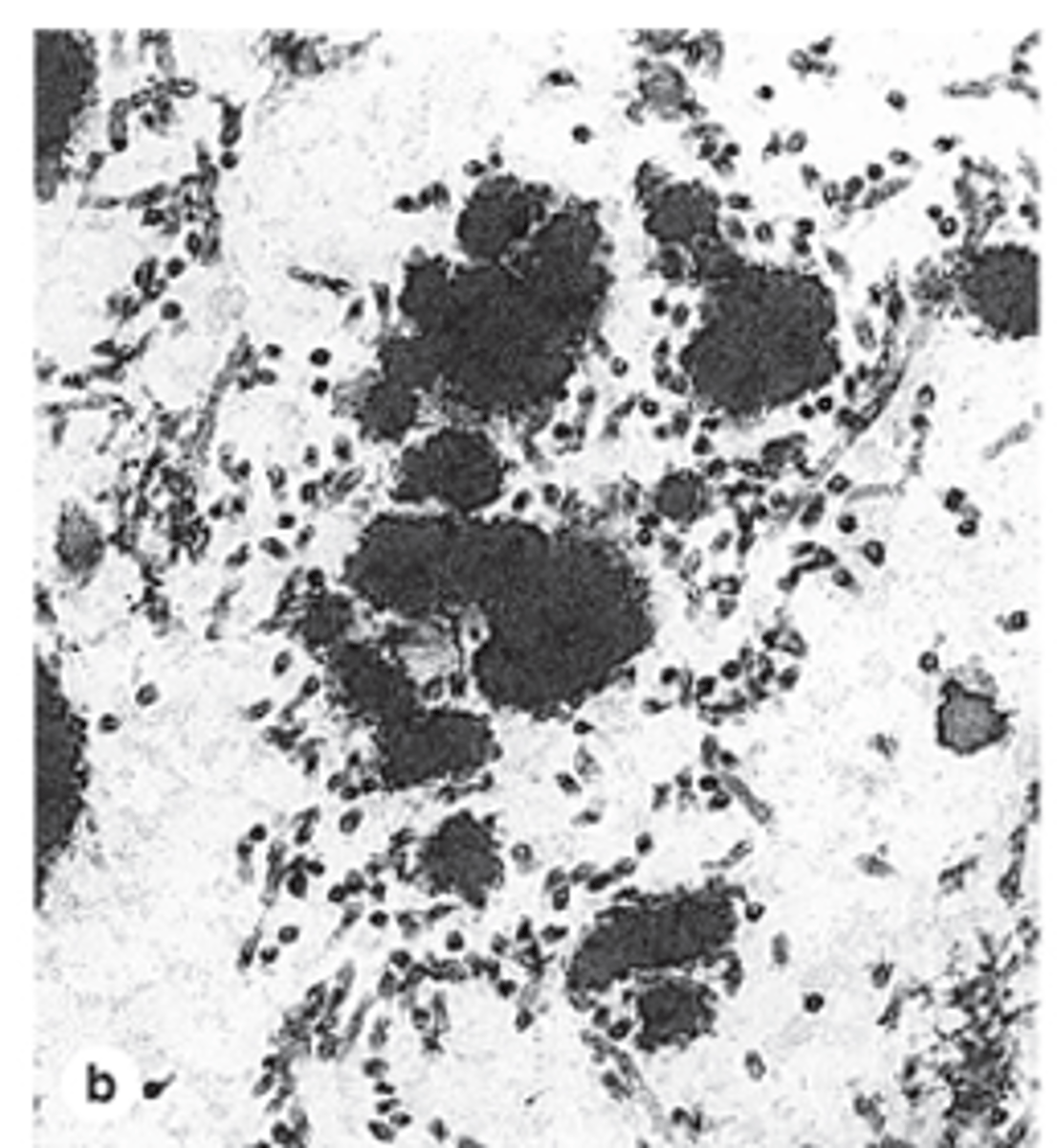 <p>How is elastin incorporated into elastic fibers?</p>