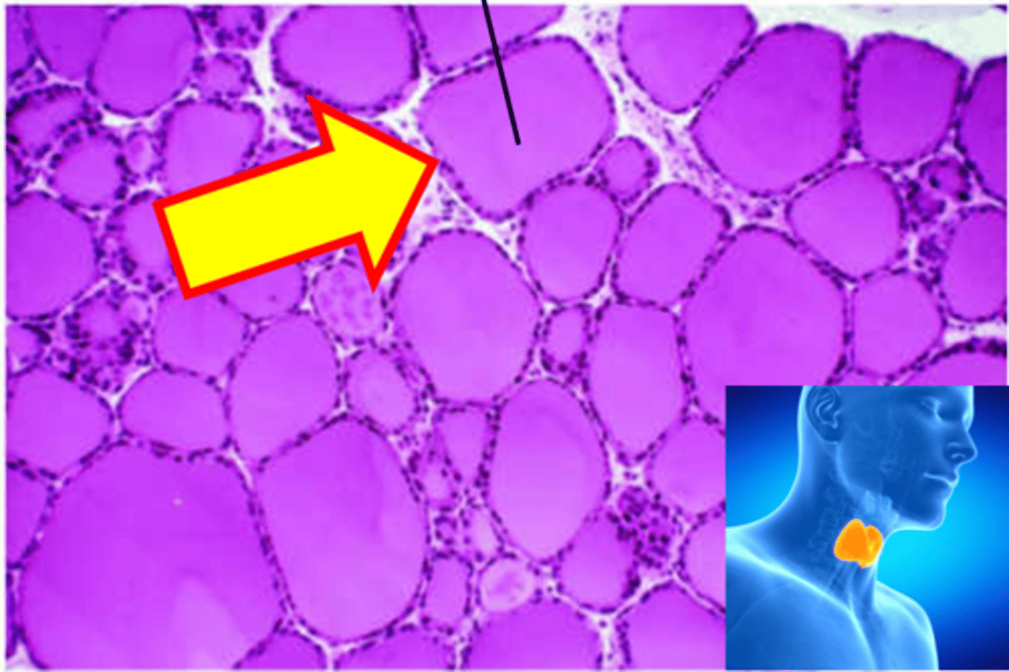 <p>Name just the outside darkly staining ring.</p>