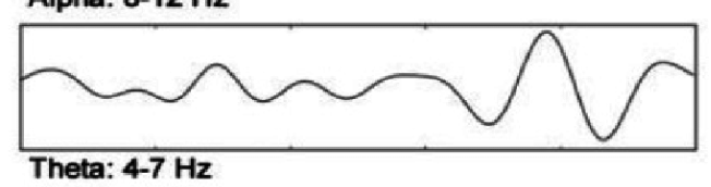 <p>What does this EEG show?</p>