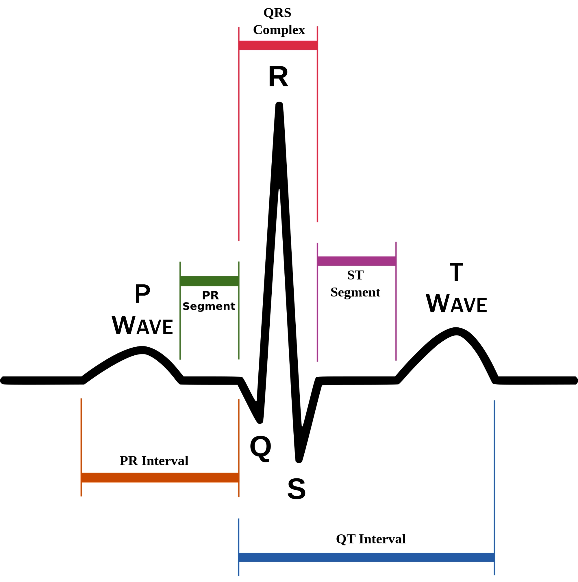 <p>P wave</p>