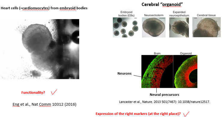 <p>The 3D approach involves removing self-renewal signals (e.g LIF/BMP for mouse ES cells and FGF2/TGFb for human ES cells) and allowing pluripotent stem cells to aggregate in suspension. These aggregates, called Embryoid Bodies, spontaneously differentiate and begin to form derivatives of all three germ layers. <br><br>With more advanced protocols, the cells can be guided to form organoids, which are complex, self-organizing 3D structures that mimic the architecture and cell types of an organ. <br></p><ul><li><p><strong>Examples:</strong> Beating heart cells (cardiomyocytes) can be seen in embryoid bodies. Cerebral organoids can be generated that develop layered structures resembling the human brain cortex, with distinct zones of neural precursors and mature neurons.</p></li><li><p><strong>Advantage:</strong> This method more accurately recapitulates the complex cell-cell interactions and 3D architecture of the *in vivo* embryonic environment.</p></li><li><p><strong>Disadvantage:</strong> It is often difficult to precisely control and observe the process, or to dissect the specific role of individual signaling molecules.</p></li></ul><p></p>