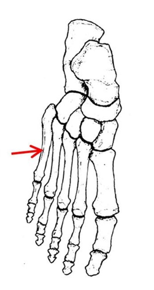 <p>ID specific bone</p>