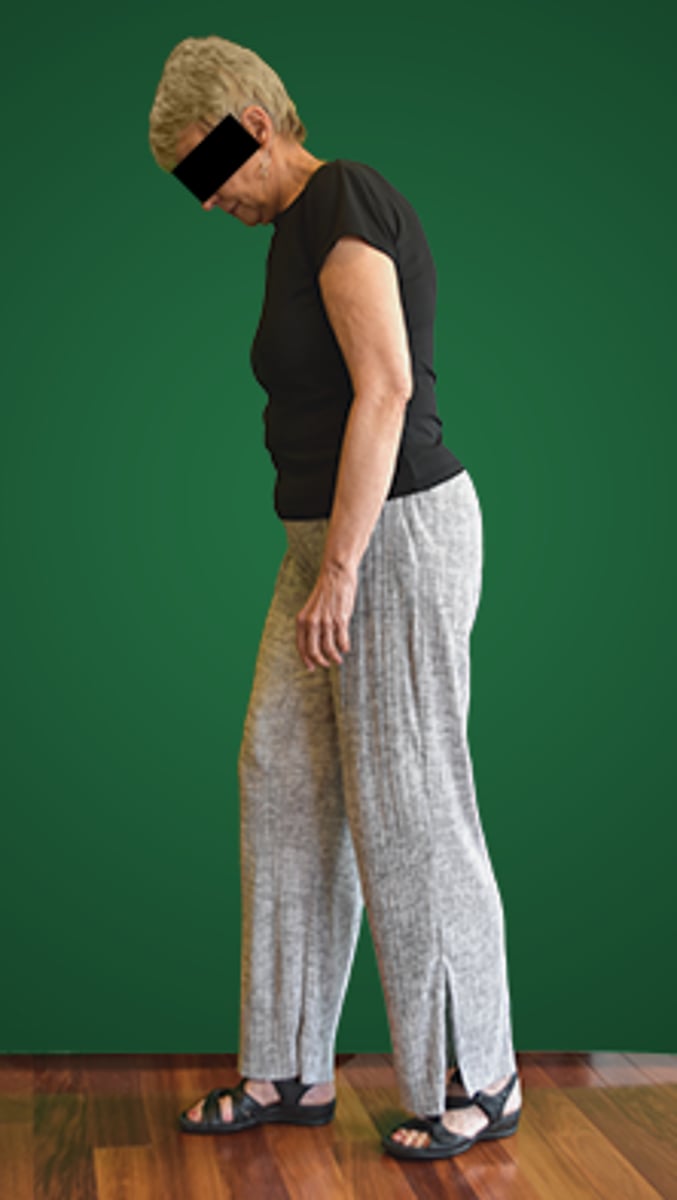 <p>4. substituting visual input for impaired proprioception in the lower extremities.</p>