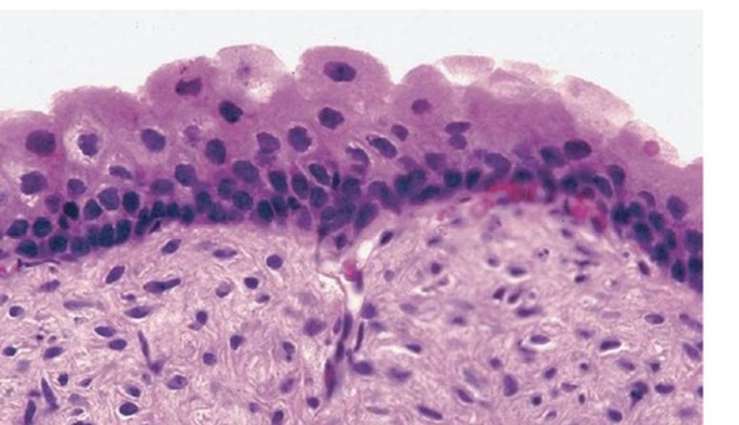<p>What epithelial tissue is this?</p>