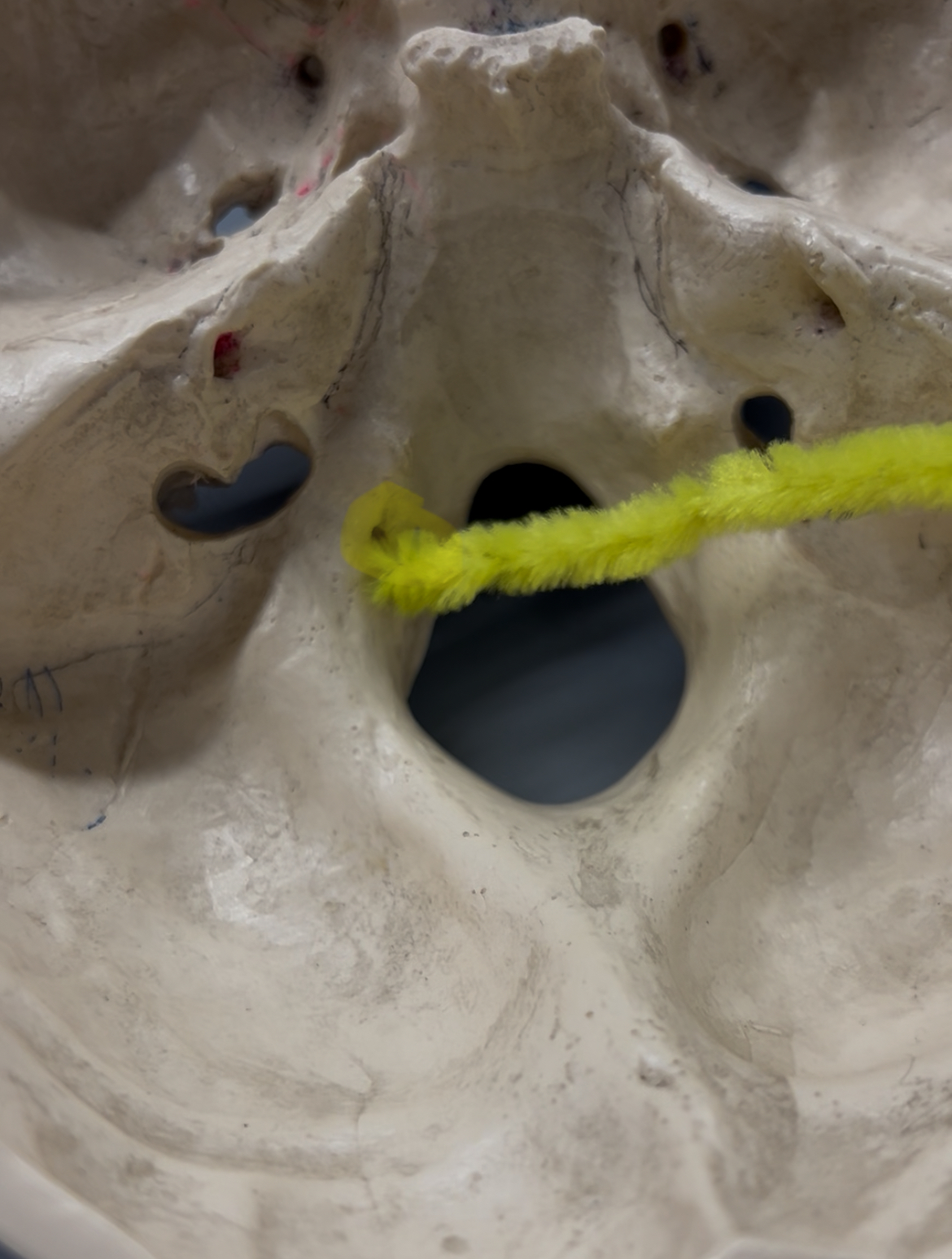 <p>What foramina is labeled by the yellow pipe? What bones are the located? Also, which if any cranial nerves pass through there?</p>