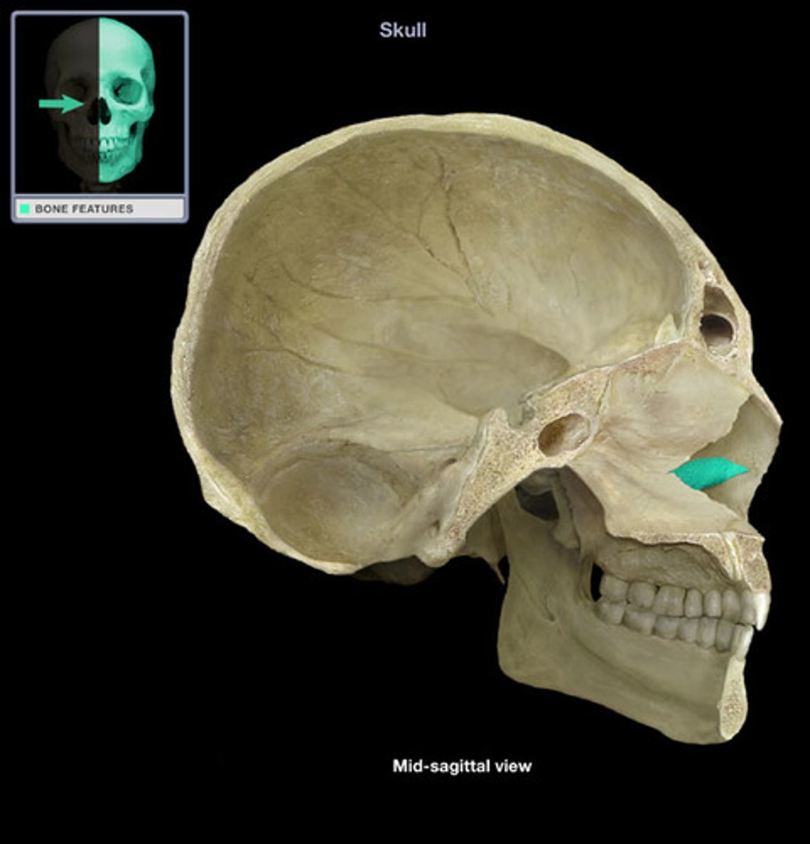 <p>One of the turbinates in the nose. It extends horizontally along the lateral wall of the nasal cavity and consists of a lamina of spongy bone, curled upon itself like a scroll.</p>