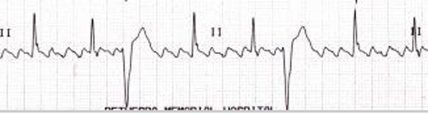 <p>angles/views of the heart that is recorded in an electrocardiogram</p>