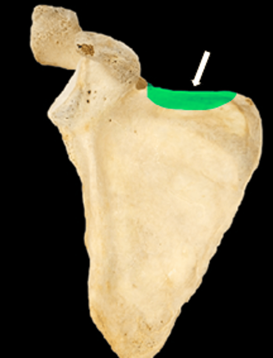 <p>name the part</p>
