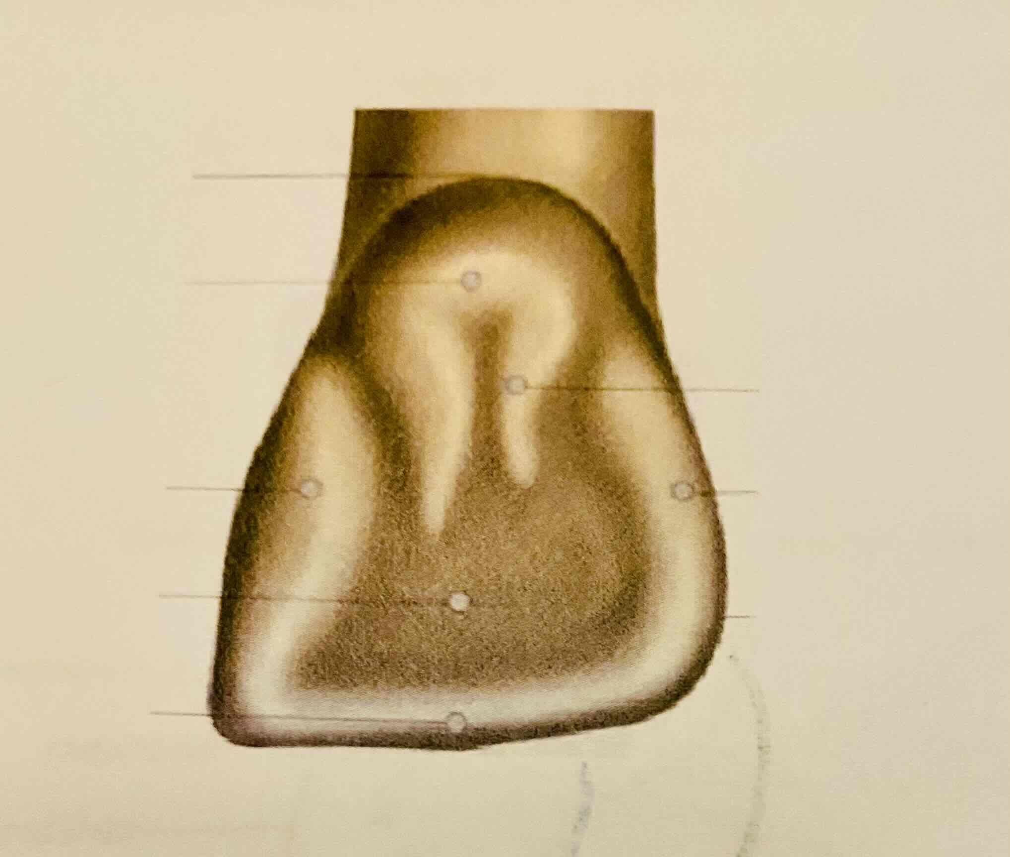 <p>Wat is het cingulum?</p>