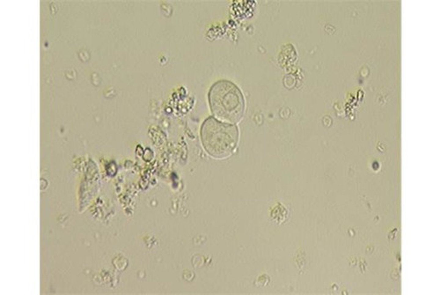 <p>From bladder, ureters, renal pelvis, and proximal urethra; round but occasionalyl pear shaped; small, granular nucleus; low numbers normal;</p>