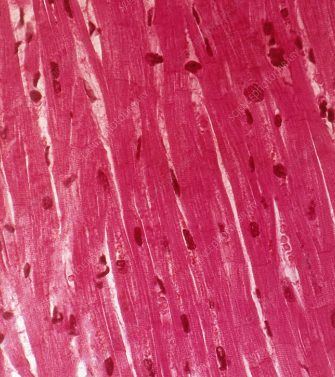 <ul><li><p>found in the walls of the heart</p></li><li><p>helps the heart to contract and pump blood</p></li></ul><p></p>