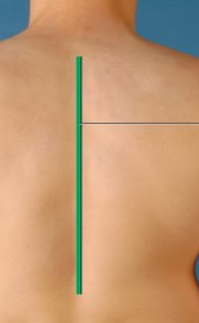 <p>runs down middle of the back (divides left and right(</p>