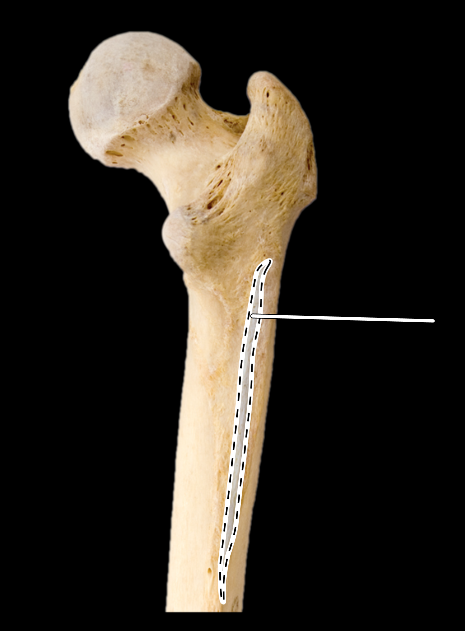 <p>Name the highlighted portion.</p><p>(Femur, posterior view, right side).</p>