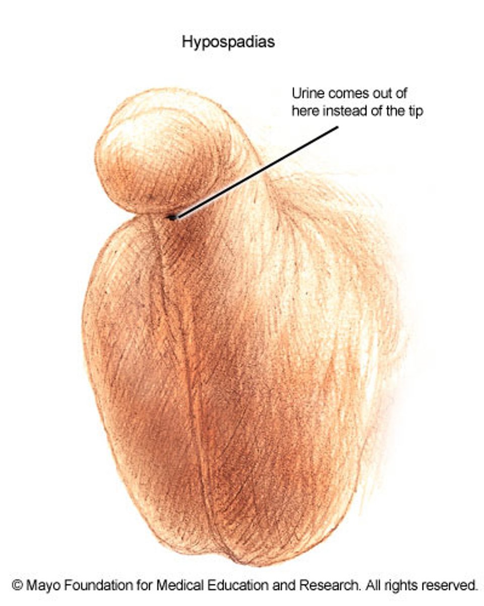<p>ventral or dorsal placement of urethral opening</p>