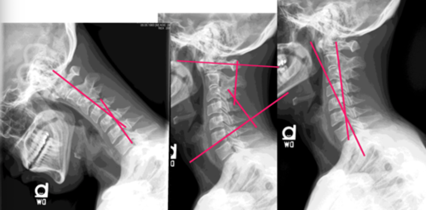 <p>Name the Roentgenometric along the sides</p>