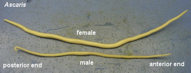 <p>difference in male and female? p?</p>