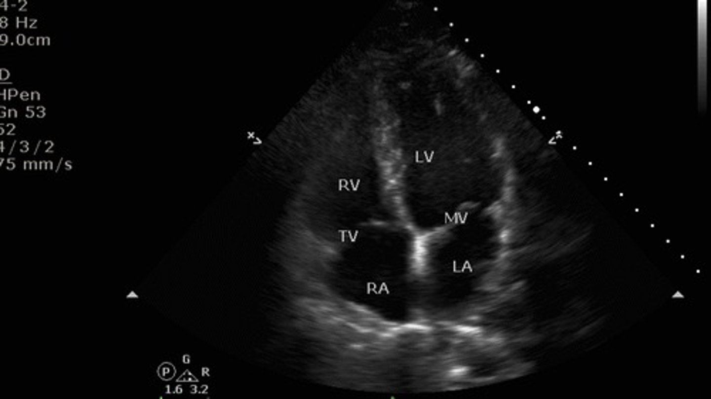 <p>what view is this?</p>