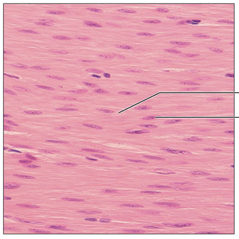 <p>What is this tissue, and where is it found?</p>
