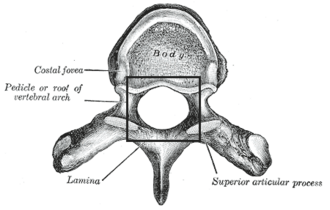 <p><span>The vertebral foramen is an opening between the body and the vertebral arch, which houses the spinal cord.</span></p>