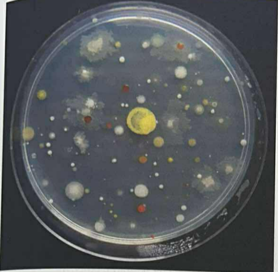 <p><span>💧📏</span> <strong>Małą objętość (ok. 0,1 ml)</strong>.</p><p><br></p><p><span data-name="round_pushpin" data-type="emoji">📍</span><span data-name="broom" data-type="emoji">🧹</span><span><span> </span></span>Materiał nanosi się pipetą na powierzchnię pożywki stałej, a następnie rozprowadza wyjałowioną głaszczką.</p><p></p><p></p><p><span data-name="petri_dish" data-type="emoji">🧫</span><span data-name="sweat_drops" data-type="emoji">💦</span><span> </span>Przy ocenie liczebności próbę powtarza się kilka razy dla różnych rozcieńczeń.</p>